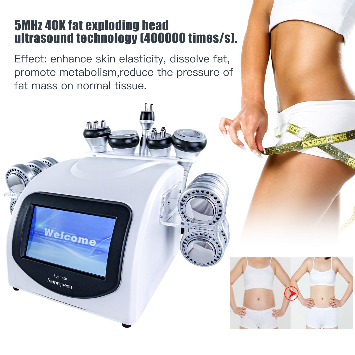 SQ47B Pro | Sculpt Fusion EMS 6-in-1 40K Body-Contouring-Gerät – Ultraschall-Kavitation, multipolare RF, Vakuummassage und EMS