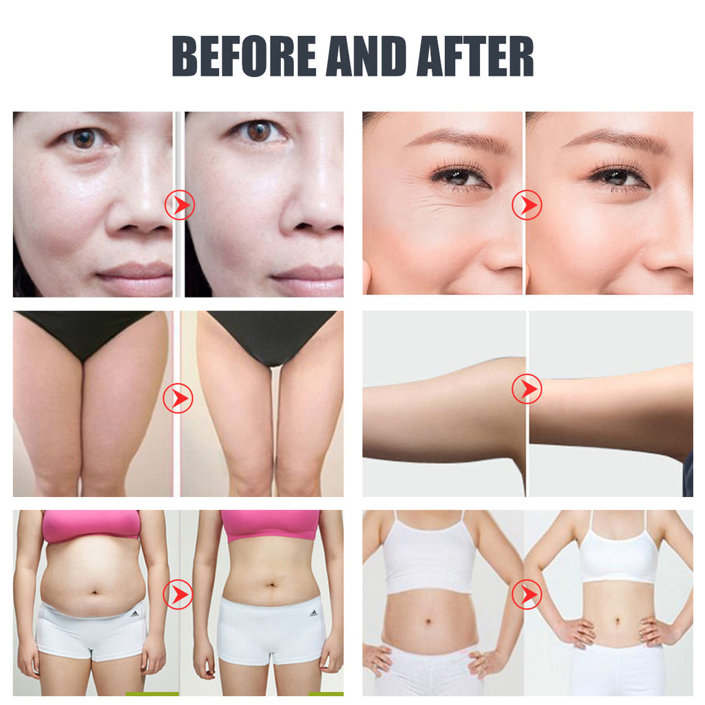 SQ47B Pro | Sculpt Fusion EMS 6-in-1 40K Body-Contouring-Gerät – Ultraschall-Kavitation, multipolare RF, Vakuummassage und EMS