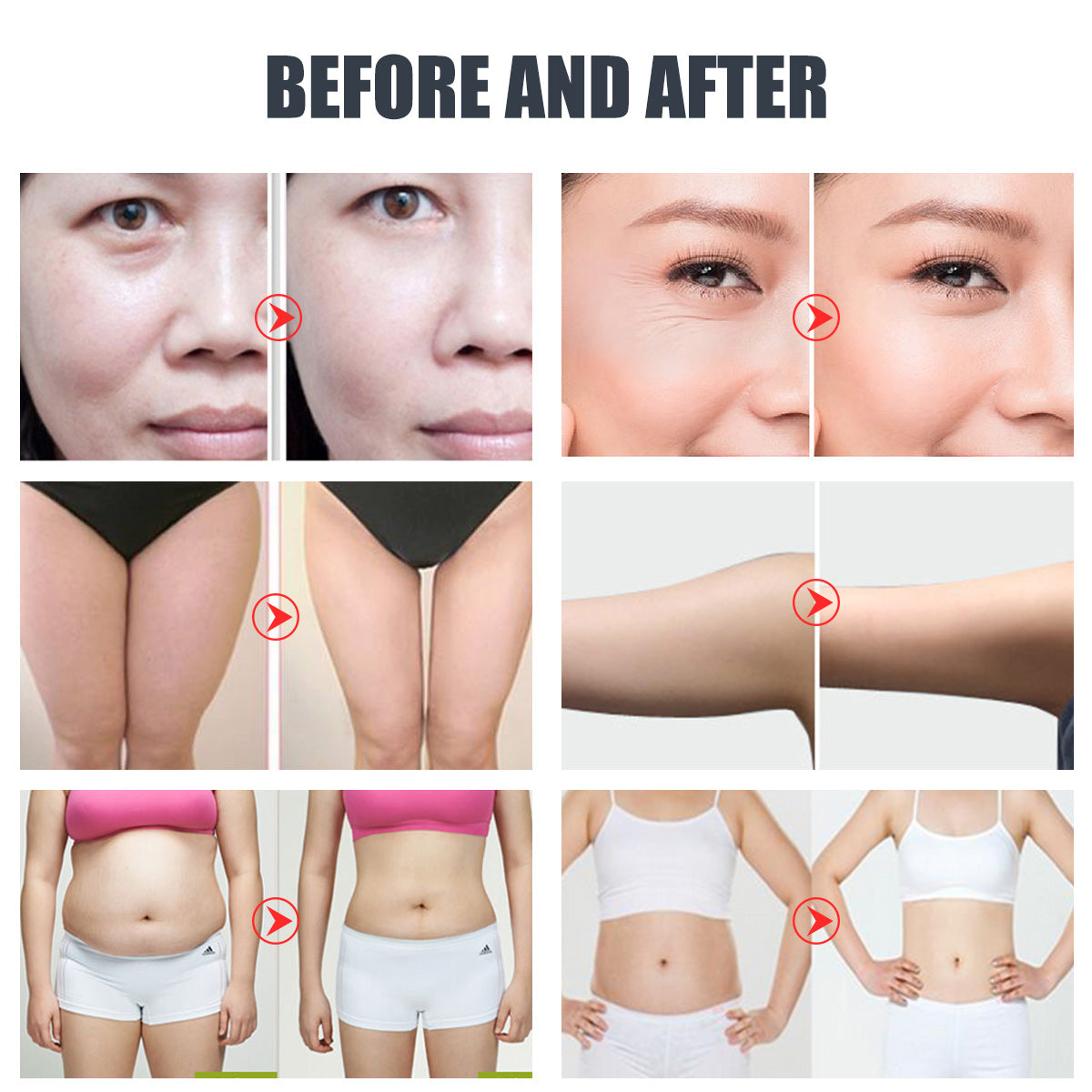 SQ47B Pro | Sculpt Fusion EMS 6-in-1 40K Body-Contouring-Gerät – Ultraschall-Kavitation, multipolare RF, Vakuummassage und EMS