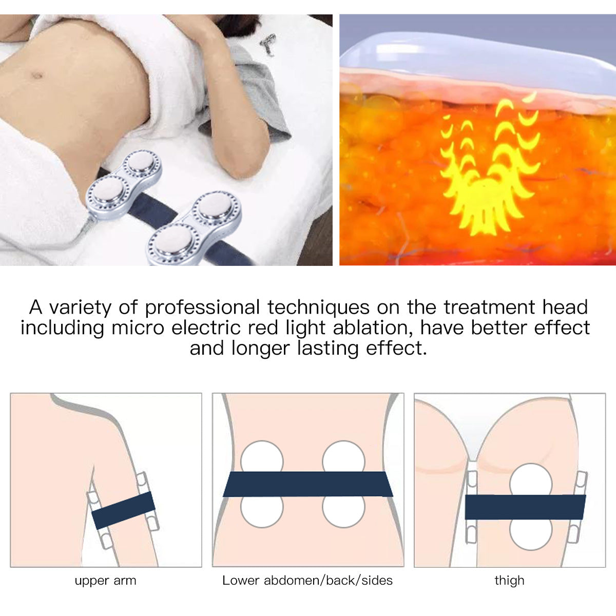 SQ47B Pro | Sculpt Fusion EMS 6-in-1 40K Body-Contouring-Gerät – Ultraschall-Kavitation, multipolare RF, Vakuummassage und EMS