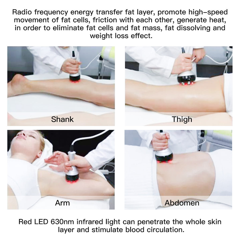 SQ47B Pro | Sculpt Fusion EMS 6-in-1 40K Body-Contouring-Gerät – Ultraschall-Kavitation, multipolare RF, Vakuummassage und EMS