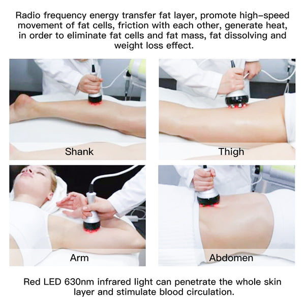 SQ47B Pro | Sculpt Fusion EMS 6-in-1 40K Body-Contouring-Gerät – Ultraschall-Kavitation, multipolare RF, Vakuummassage und EMS