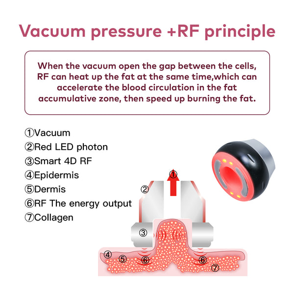 SQ16B Basic | Essential Contour Vacuum 4-in-1 40K Body-Contouring-Gerät – Ultraschall-Kavitation, multipolare RF und Vakuummassage