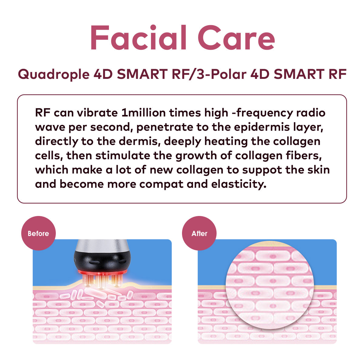 SQ16B Basic | Essential Contour Vacuum 4-in-1 40K Body-Contouring-Gerät – Ultraschall-Kavitation, multipolare RF und Vakuummassage