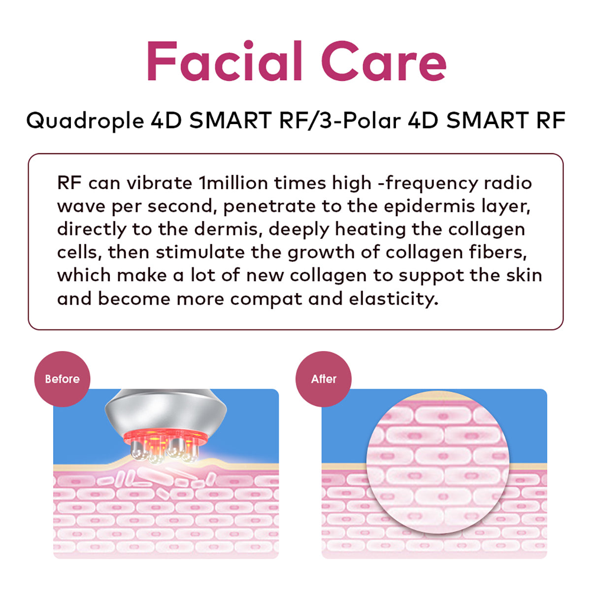 SQ90E Plus | Form & Firm Vacuum + Microcurrent 9-in-1 80K Body-Contouring-Gerät – Ultraschall-Kavitation, multipolare RF, Vakuummassage und Laser-Lipo-Pads