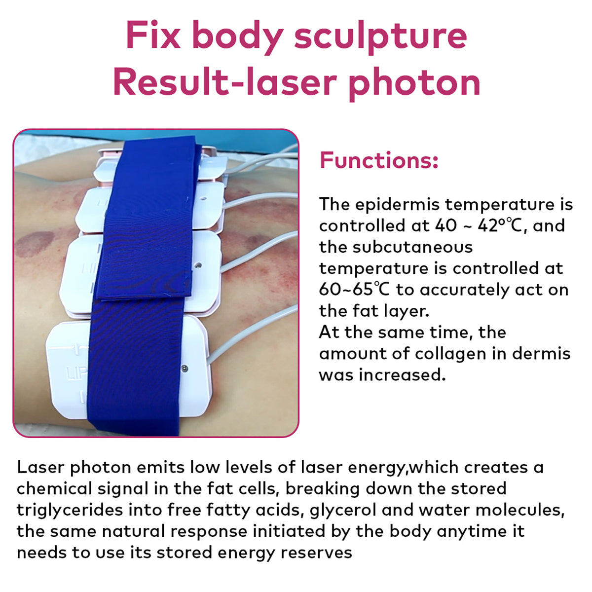 SQ92D Plus | Contour Complete Laser + Microcurrent 9-in-1 80K Body-Contouring-Gerät – Ultraschall-Kavitation, multipolare RF, Laser-Lipo-Pads und Mikrostrom