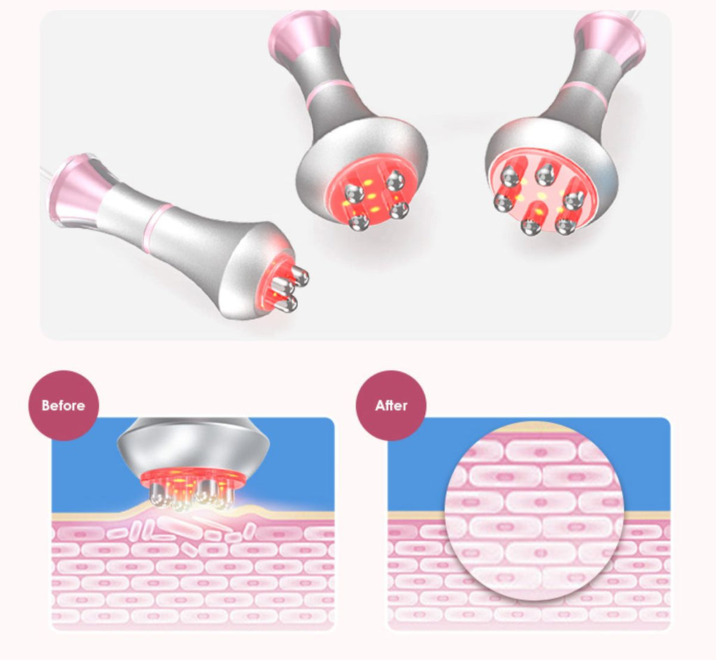 SQ121A Pro | Contour Pro Laser Pad 6-in-1 80K Body-Contouring-Gerät – Ultraschall-Kavitation, multipolare RF, Vakuummassage und Laser-Lipo-Pads
