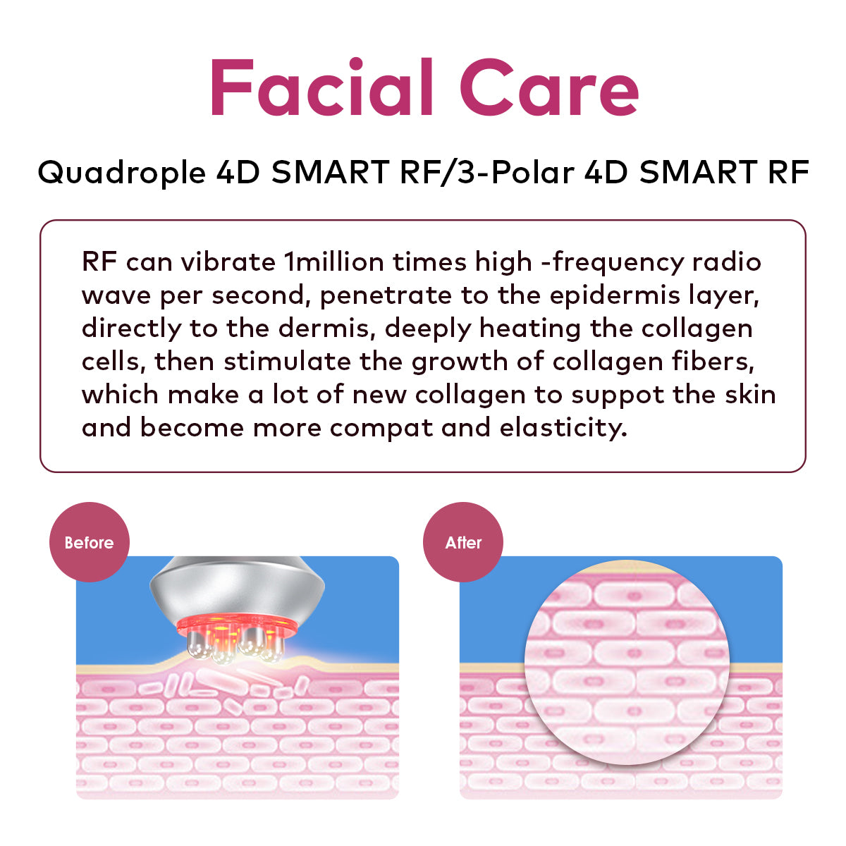SQ121C Plus | Contour Plus EMS 9-in-1 80K Body-Contouring-Gerät – Ultraschall-Kavitation, multipolare RF, Vakuummassage und Laser-Lipo-Pads